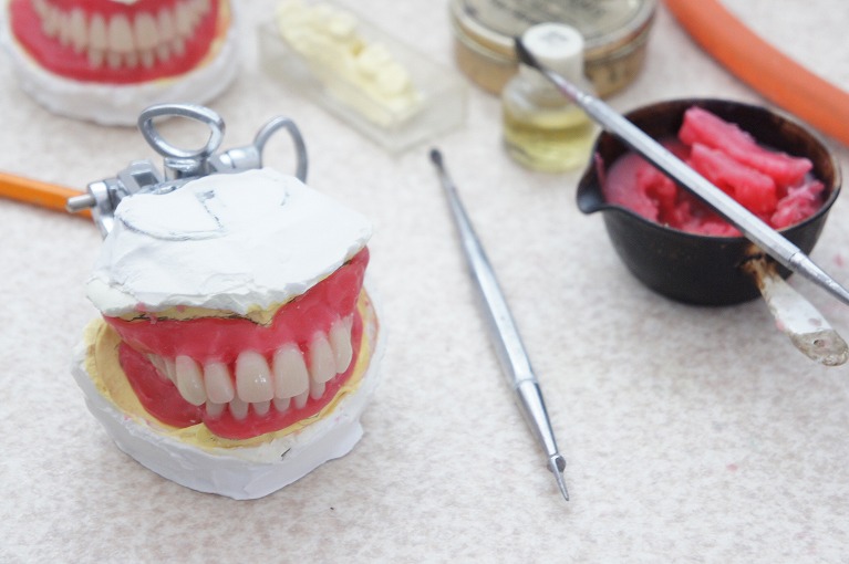 当院における入れ歯の治療